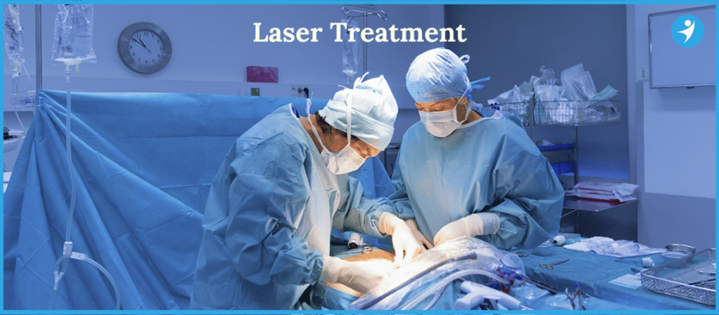 Laser Treatment for Piles in Bangalore