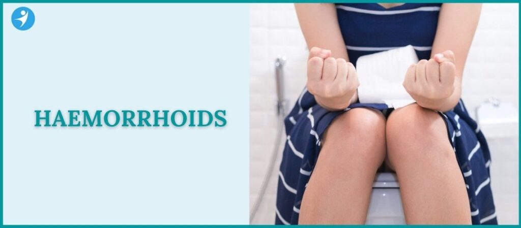 Haemorrhoids - Piles Doctors in Bangalore - Dr Manas Tripathy