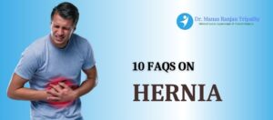 Faqs on Hernia - Best Proctologists in Bangalore - Dr. Manas Tripathy