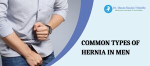 Types-Of-Hernia-in-Men-Hernia-Surgery-in-Bangalore-Dr.-Manas-Tripathy
