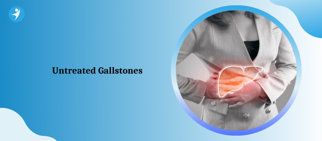 Untreated Gallstones | Gallstone Treatment in Bangalore | Dr. Manas Tripathy