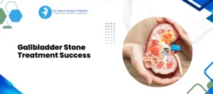 Laser Proctology for Piles & Fissures in Bangalore