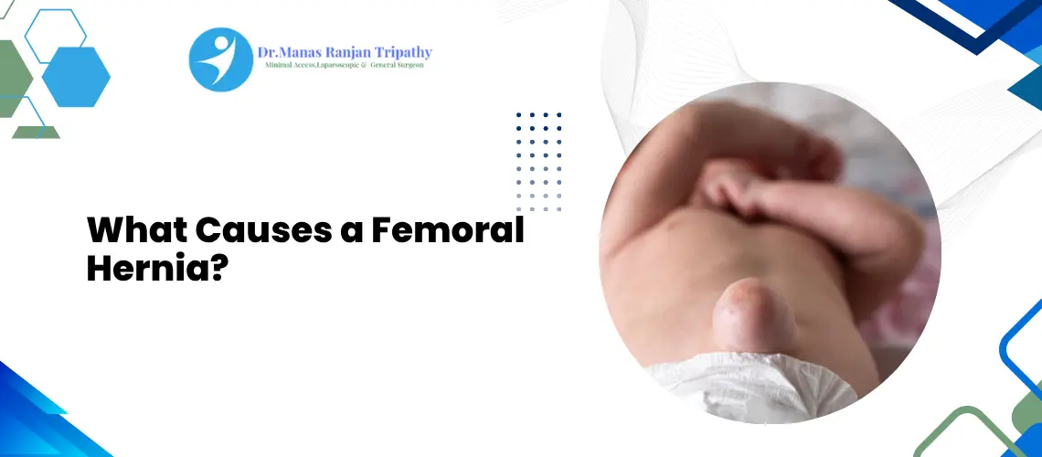 Best Hernia Treatment in Bangalore