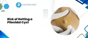 Pilonidal Cyst Treatment in Bangalore