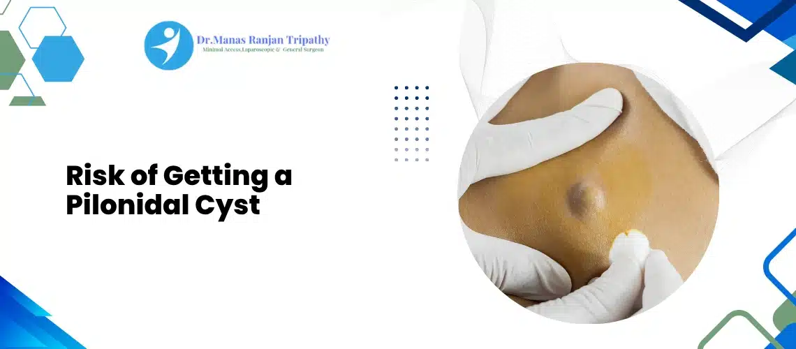 Pilonidal Cyst Treatment in Bangalore
