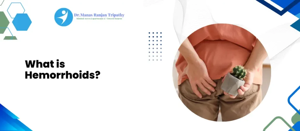 Hemorrhoids Treatment in HSR Layout