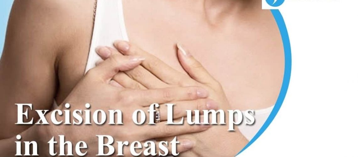 Excision of Lumps in the Breast
